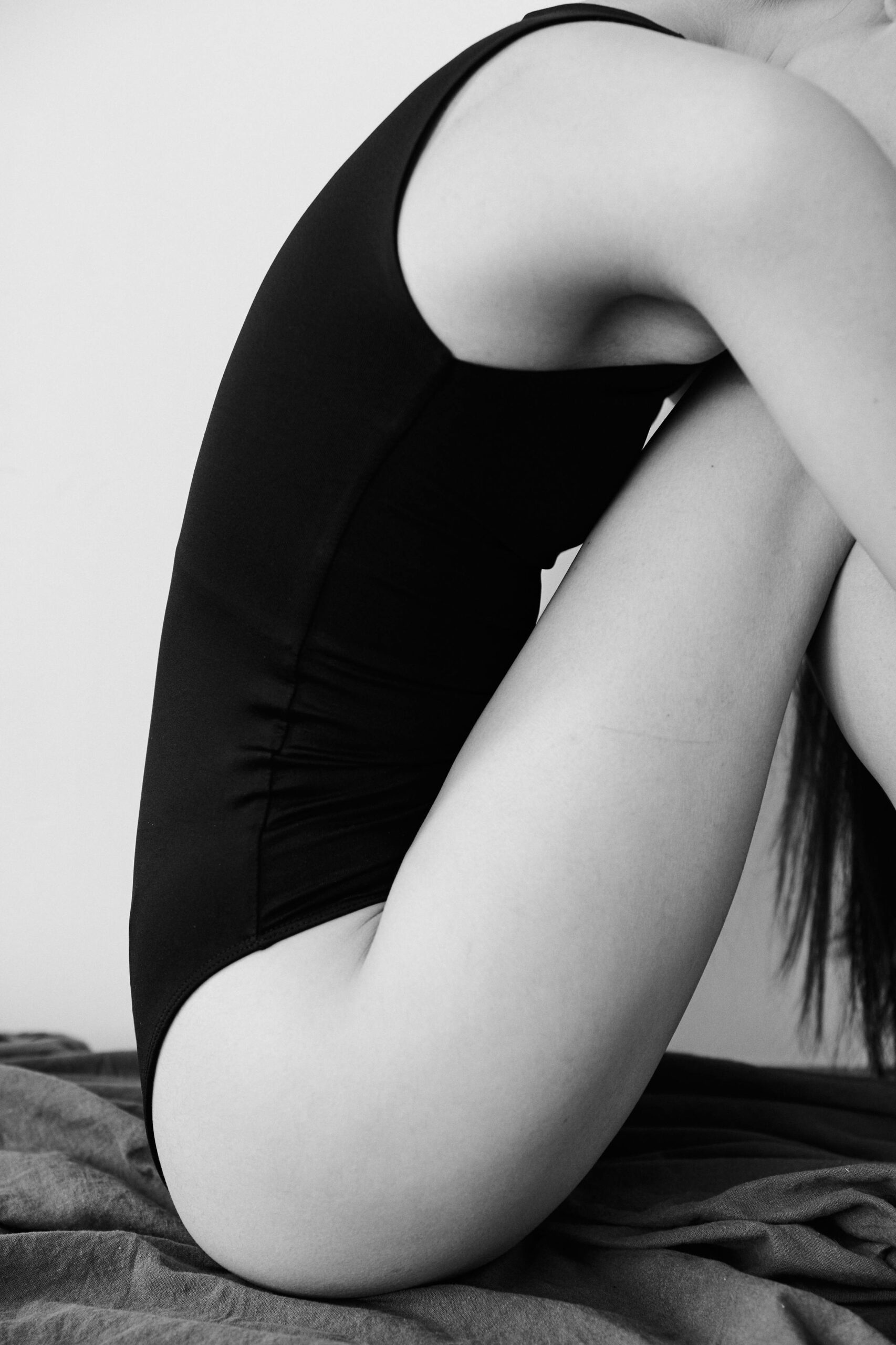 Pilvo plastika (abdominoplastika)